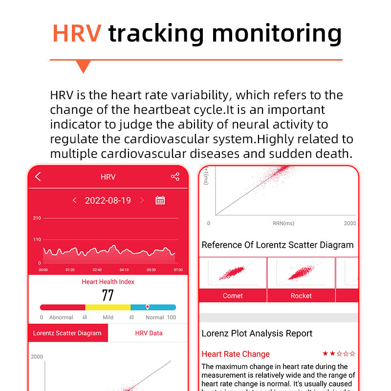 Sleek Health Monitoring Smartwatch with ECG and Blood Pressure – Ideal for Everyday Wear